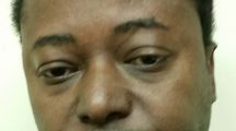 Radcliffe Rose a RN was arrested for allegedly engaging in sexual conduct with a physically helpless and mentally incapacitated victim.
